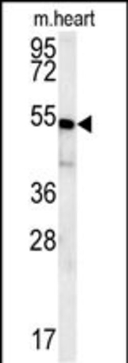 Invitrogen HEY2 Polyclonal Antibody 400 &mu;L; Unconjugated:Antibodies,