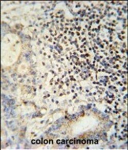 Invitrogen ESRP1 Polyclonal Antibody 400 &mu;L; Unconjugated:Antibodies,