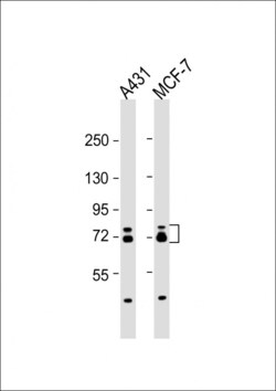 Invitrogen ESRP1 Polyclonal Antibody 400 &mu;L; Unconjugated:Antibodies,