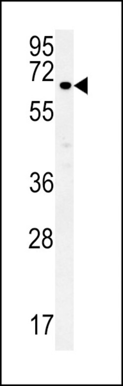 Invitrogen ESRP1 Polyclonal Antibody 400 &mu;L; Unconjugated:Antibodies,