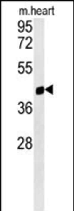 Invitrogen PTGR1 Polyclonal Antibody 400 &mu;L; Unconjugated:Antibodies,