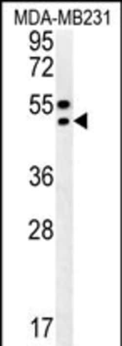 Invitrogen TRAM2 Polyclonal Antibody 400 &mu;L | Buy Online | Invitrogen&trade; | Fisher Scientific