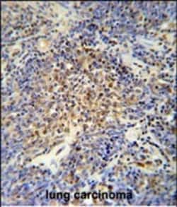 Invitrogen OTUD4 Polyclonal Antibody 400 &mu;L; Unconjugated:Antibodies,