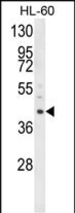 Invitrogen LRG1 Polyclonal Antibody 400 &mu;L | Buy Online | Invitrogen&trade; | Fisher Scientific