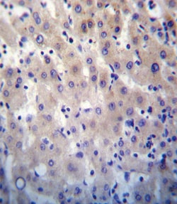 Invitrogen HPRT1 Polyclonal Antibody 400 &mu;L; Unconjugated:Antibodies,