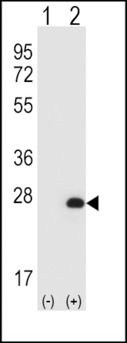 Invitrogen HPRT1 Polyclonal Antibody 400 &mu;L; Unconjugated:Antibodies,