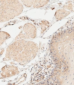 Invitrogen IL-1 alpha Polyclonal Antibody 400 &mu;L; Unconjugated:Antibodies,