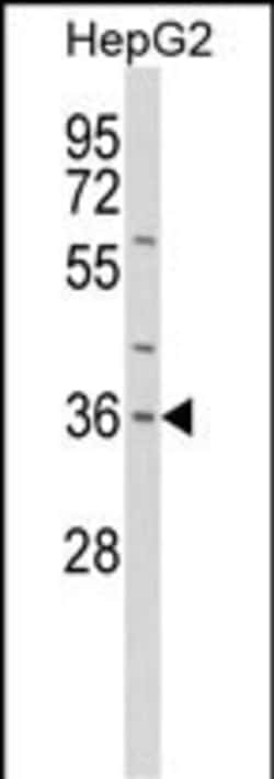 Invitrogen IL-1 alpha Polyclonal Antibody 400 &mu;L; Unconjugated:Antibodies,