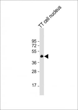 Invitrogen Nkx2.1 Polyclonal Antibody 400 &mu;L | Buy Online | Invitrogen&trade; | Fisher Scientific