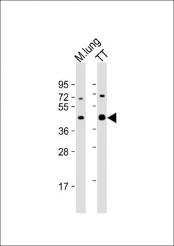 Invitrogen Nkx2.1 Polyclonal Antibody 400 &mu;L | Buy Online | Invitrogen&trade; | Fisher Scientific