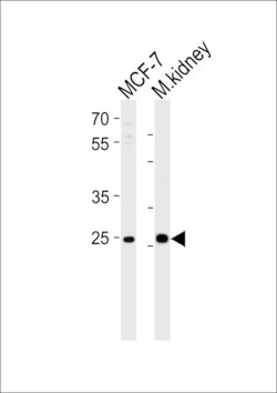 Invitrogen Carbonic Anhydrase II Polyclonal Antibody 400 &mu;L; Unconjugated:Antibodies,