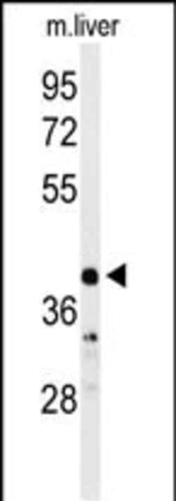 Invitrogen Carbonic Anhydrase VB Polyclonal Antibody 400 &mu;L; Unconjugated:Antibodies,