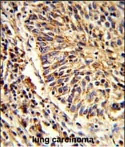 Invitrogen ADAM9 Polyclonal Antibody 400 &mu;L; Unconjugated:Antibodies,