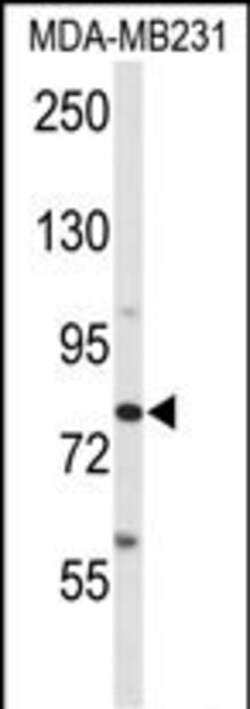 Invitrogen ADAM9 Polyclonal Antibody 400 &mu;L; Unconjugated:Antibodies,