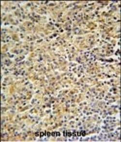 Invitrogen HCK Polyclonal Antibody 400 &mu;L; Unconjugated:Antibodies,