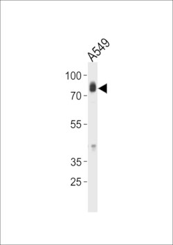 Invitrogen HCK Polyclonal Antibody 400 &mu;L; Unconjugated:Antibodies,