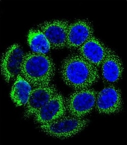 Invitrogen CYP21A2 Polyclonal Antibody 400 μL; Unconjugated:Antibodies,