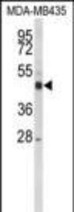 Invitrogen CYP21A2 Polyclonal Antibody 400 μL; Unconjugated:Antibodies,