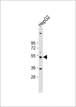 Invitrogen CYP3A43 Polyclonal Antibody 400 &mu;L | Buy Online | Invitrogen&trade; | Fisher Scientific