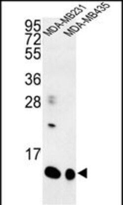Invitrogen SPRR1B Polyclonal Antibody 400 &mu;L; Unconjugated:Antibodies,