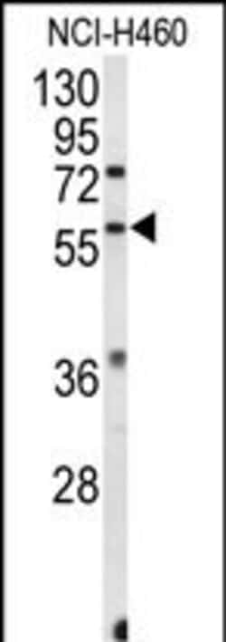 Invitrogen ESRRB Polyclonal Antibody 400 &mu;L; Unconjugated:Antibodies,