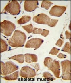 Invitrogen Neuropilin 1 Polyclonal Antibody 400 &mu;L; Unconjugated:Antibodies,
