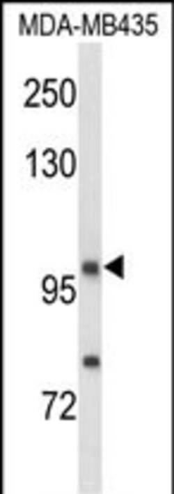 Invitrogen Neuropilin 1 Polyclonal Antibody 400 &mu;L; Unconjugated:Antibodies,