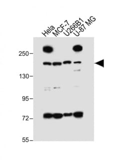 Invitrogen UTY Polyclonal Antibody 400 μL; Unconjugated:Antibodies,
