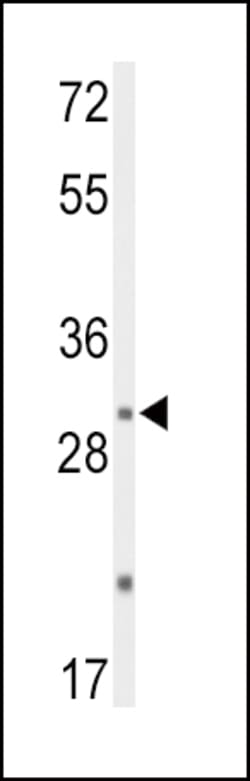 Invitrogen&trade;&nbsp;DUSP2 Polyclonal Antibody