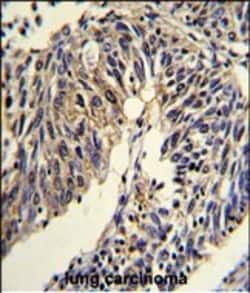 Invitrogen TNFRSF14 Polyclonal Antibody 400 &mu;L; Unconjugated:Antibodies,