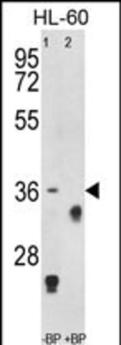 Invitrogen TNFRSF14 Polyclonal Antibody 400 &mu;L; Unconjugated:Antibodies,