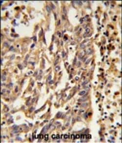 Invitrogen KIF11 Polyclonal Antibody 400 &mu;L; Unconjugated:Antibodies,