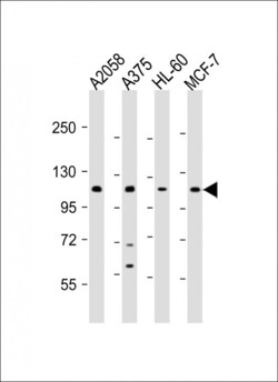 Invitrogen COL17A1 Polyclonal Antibody 400 &mu;L; Unconjugated:Antibodies,