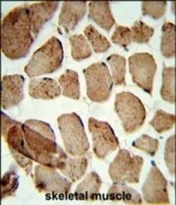 Invitrogen ULK1 (denatured) Polyclonal Antibody 400 &mu;L; Unconjugated:Antibodies,