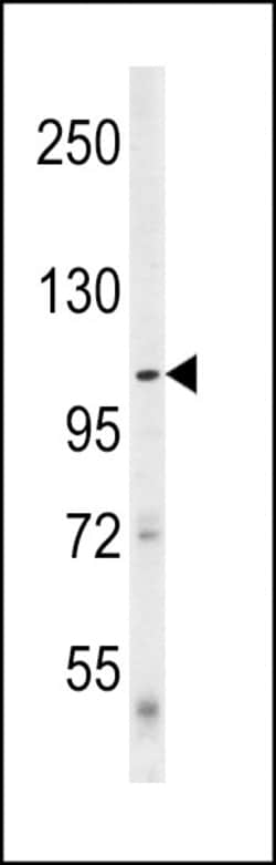 Invitrogen ULK1 (denatured) Polyclonal Antibody 400 &mu;L; Unconjugated:Antibodies,