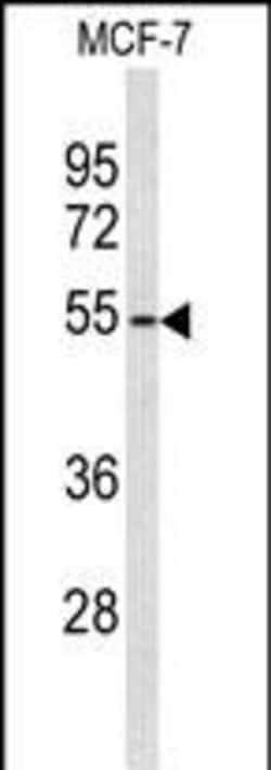 Invitrogen ADAMDEC1 Polyclonal Antibody 400 &mu;L | Buy Online | Invitrogen&trade; | Fisher Scientific