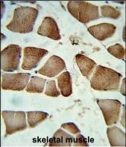 Invitrogen DIPA Polyclonal Antibody 400 &mu;L | Buy Online | Invitrogen&trade; | Fisher Scientific
