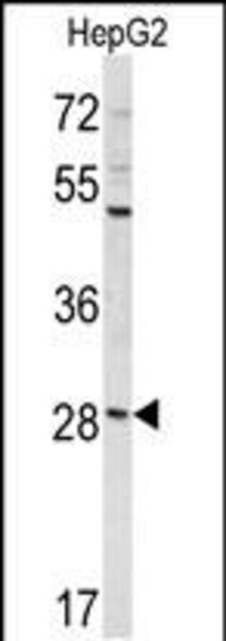 Invitrogen DIPA Polyclonal Antibody 400 &mu;L | Buy Online | Invitrogen&trade; | Fisher Scientific