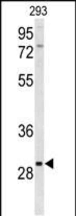 Invitrogen CLRN3 Polyclonal Antibody 400 &mu;L; Unconjugated:Antibodies,
