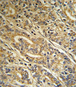 Invitrogen ACOT8 Polyclonal Antibody 400 &mu;L; Unconjugated:Antibodies,