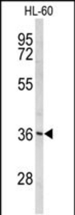 Invitrogen PEX14 Polyclonal Antibody 400 &mu;L; Unconjugated:Antibodies,