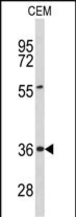 Invitrogen PEX16 Polyclonal Antibody 400 &mu;L; Unconjugated:Antibodies,