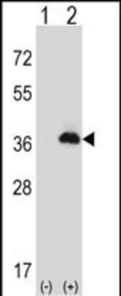 Invitrogen PEX16 Polyclonal Antibody 400 &mu;L; Unconjugated:Antibodies,