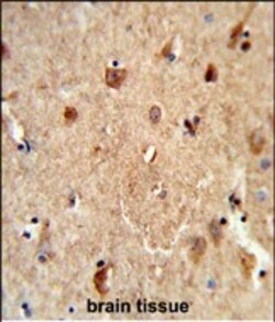 Invitrogen CES7 Polyclonal Antibody 400 &mu;L; Unconjugated:Antibodies,