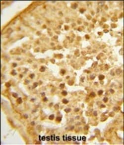 Invitrogen BAHD1 Polyclonal Antibody 400 &mu;L; Unconjugated:Antibodies,