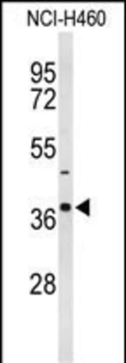 Invitrogen SLC25A17 Polyclonal Antibody 400 &mu;L; Unconjugated:Anticorps,