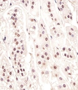 Invitrogen Cdc73 Polyclonal Antibody 400 &mu;L; Unconjugated:Antibodies,