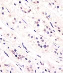Invitrogen Cdc73 Polyclonal Antibody 400 &mu;L; Unconjugated:Antibodies,