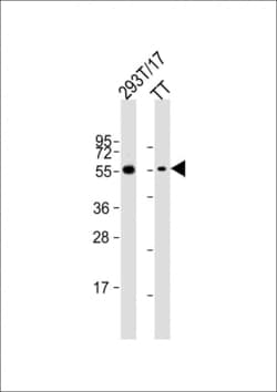 Invitrogen Cdc73 Polyclonal Antibody 400 &mu;L; Unconjugated:Antibodies,