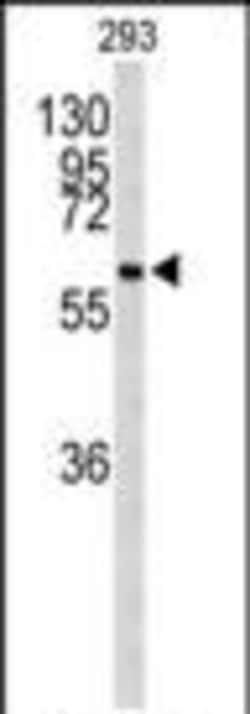 Invitrogen Cdc73 Polyclonal Antibody 400 &mu;L; Unconjugated:Antibodies,
